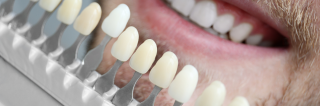 periodoncista de implantes dentales acapulco de juarez OdontoTecnic