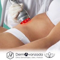clinica dermatologica aguascalientes Dermavanzada Clínica Láser y Nutrición Dra. Gabriela Romero V.