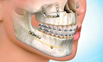 dentistas ortodoncistas en ciudad de mexico Ortodoncia, Brackets - Dentista, Dra. Iris Ocampo