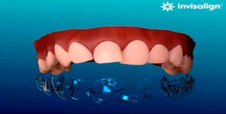 dentistas ortodoncistas en ciudad de mexico Ortodoncia, Brackets - Dentista, Dra. Iris Ocampo