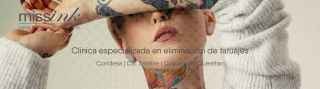 clinicas que eliminan tatuajes ciudad de mexico Missink Satelite