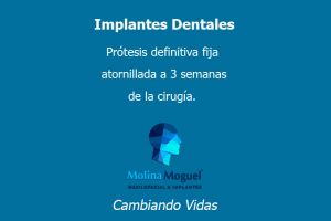 formaciones en implantologia en ciudad de mexico Cirujano Maxilofacial | DR. MOLINA MOGUEL