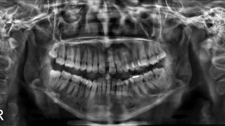 radiologia dental ciudad lopez mateos URx Unidad de Radiodiagnóstico Bucal y Craneofacial