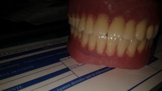 proveedor de implantes dentales cuautitlan izcalli Laboratorio dental ODIN-T MÉXICO