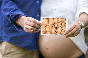 DRA. OSIRIS COTERO ROBLES - ultrasonido de embarazos