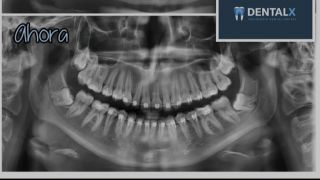 radiologia dental morelia DentalX