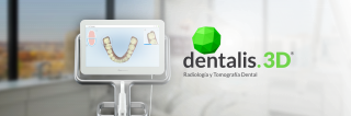 radiologia dental morelia Dentalis 3D Radiología y Tomografía Dental