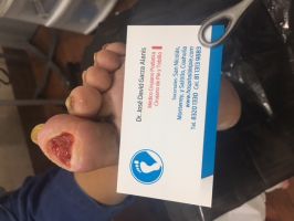 hospital especializado saltillo Hospital del Pie Diabético y Manejo Avanzado De Heridas