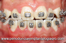 periodoncista de implantes dentales santiago de queretaro Jimenez Mendez Carolina Guadalupe