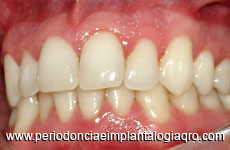 periodoncista de implantes dentales santiago de queretaro Jimenez Mendez Carolina Guadalupe