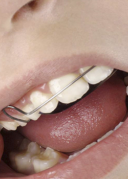 cirujano oral y maxilofacial tlalnepantla de baz MaxiloCenter - Clínica de Cirugía Oral y Maxilofacial