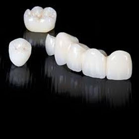 ortodoncista tlalnepantla de baz Consultorio Dental Dr. Roberto Montero. Ortodoncia