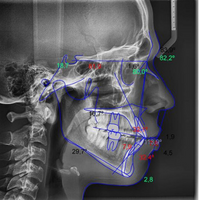 radiologia dental tlaquepaque Dentimagen 3D