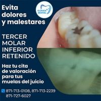 DR. MANUEL ACUÑA C – Dentista en Torreón
