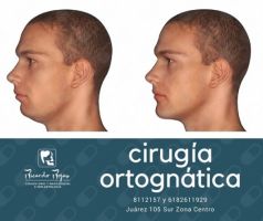 cirujano oral victoria de durango Cirugía Maxilofacial Durango Dr Ricardo Rojas